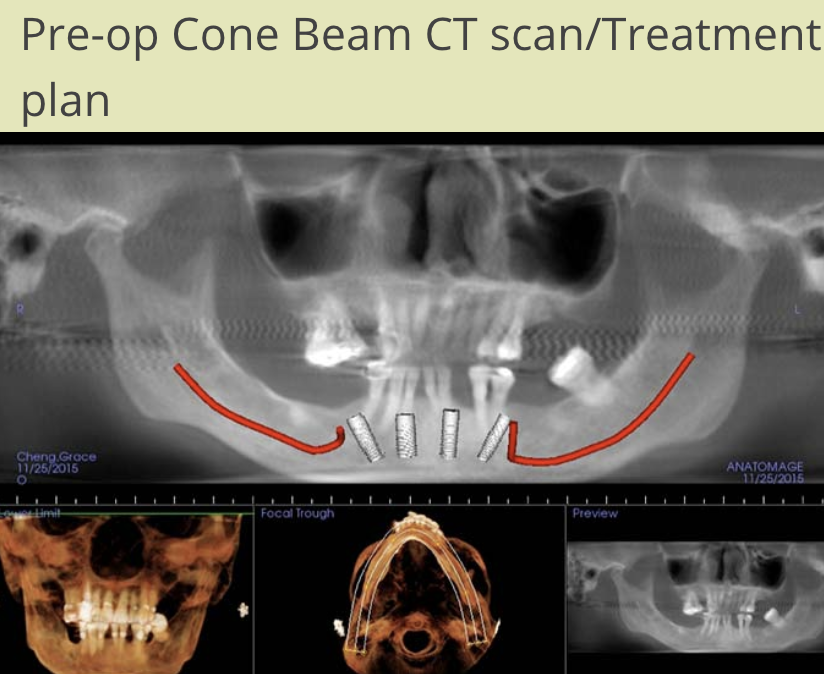 Patient 2-Photo3
