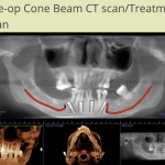 Patient 2-Photo3