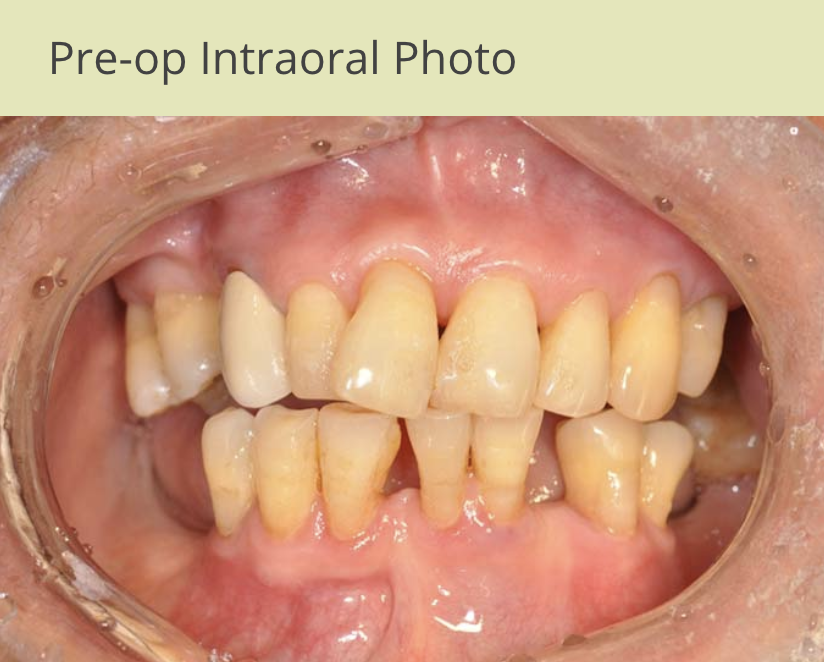 Patient2-Photo2