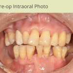 Patient2-Photo2