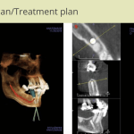 Patient2-Photo3