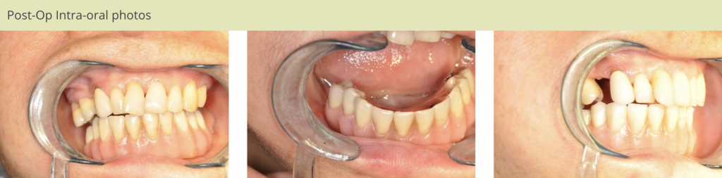 Patient2-Photo4