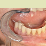 Patient2-Photo4